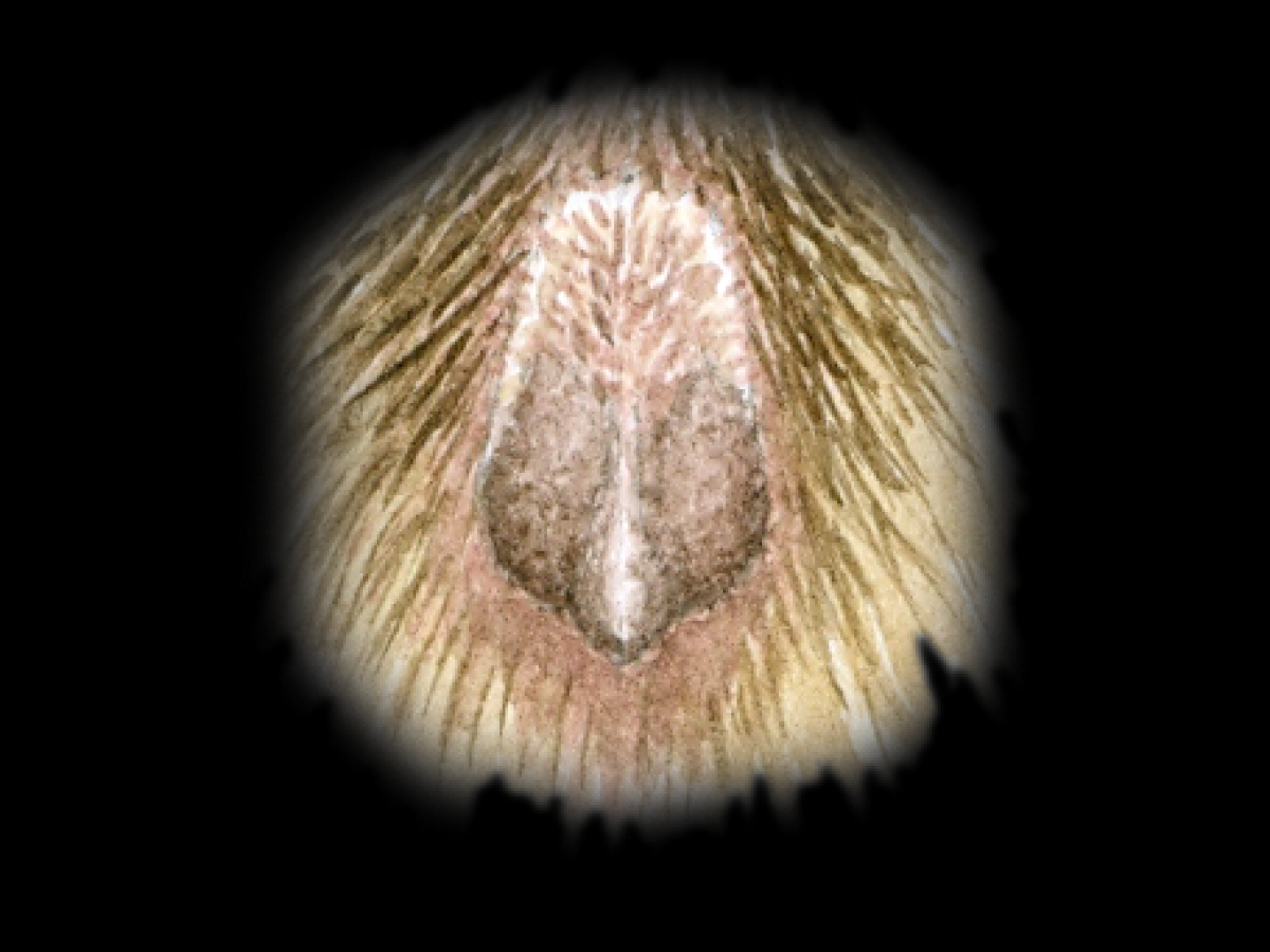 Penis. Peter Twisk